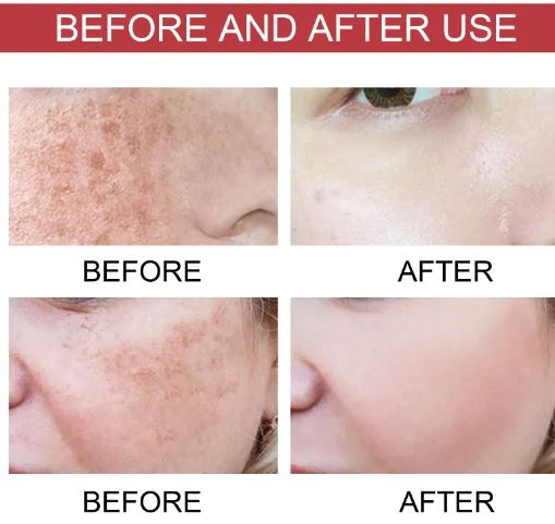 Niacinamide Hydrating Skin Formula