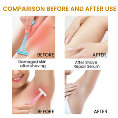 Bikini Area Hair Serum for Irritation Relief and Smooth Skin